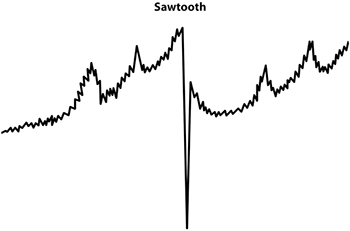 圖30：鋸齒波形是同時傳遞多種頻率的理想選擇